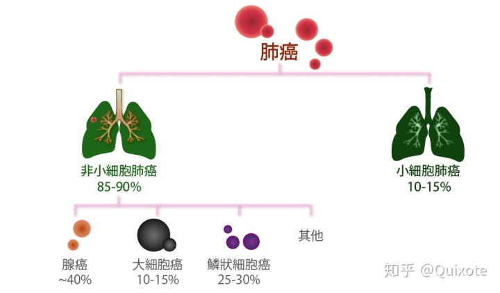 印戒细胞癌早期症状_透明细胞肾细胞癌_戒烟激活癌细胞