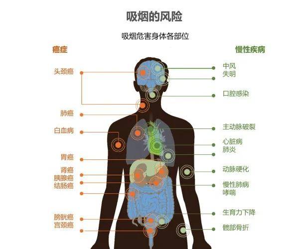 戒烟激活癌细胞_黑色素细胞癌症状_小细胞癌戒烟