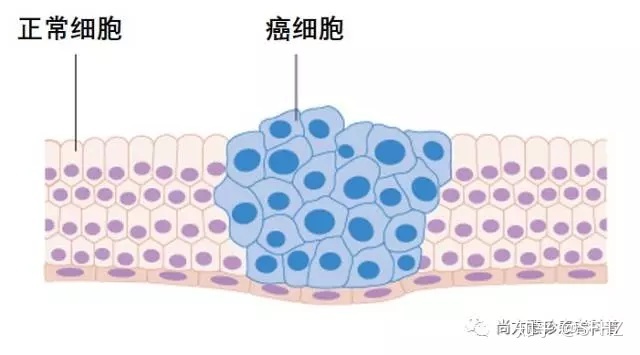 戒烟激活癌细胞_为什么突然戒烟会得癌_戒烟后真的会得癌吗