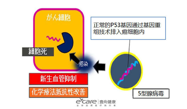 戒烟激活癌细胞_胃癌印戒细胞癌术后饮食_印戒细胞癌早期症状