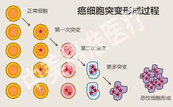 戒烟激活癌细胞_戒烟后得癌的人多不多_印戒细胞癌能活多久