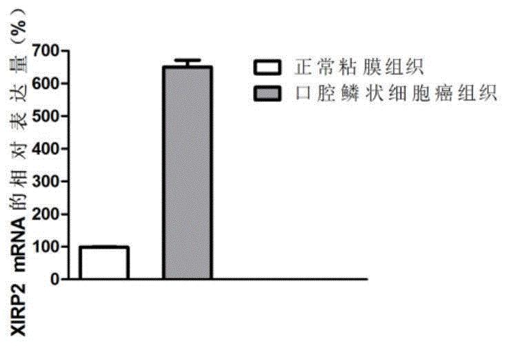 戒烟激活癌细胞_戒烟后得癌的人多不多_透明细胞肾细胞癌