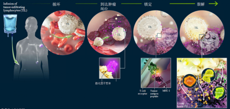 胃窦印戒细胞癌应该看哪个科_透明细胞肾细胞癌_戒烟激活癌细胞