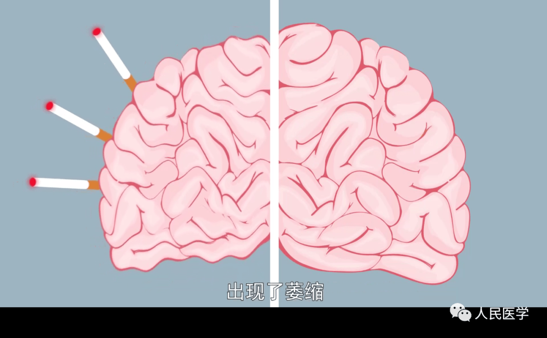 戒烟的花费_戒烟使用戒烟贴有用吗_这书能让你永久戒烟 这书能让你戒烟