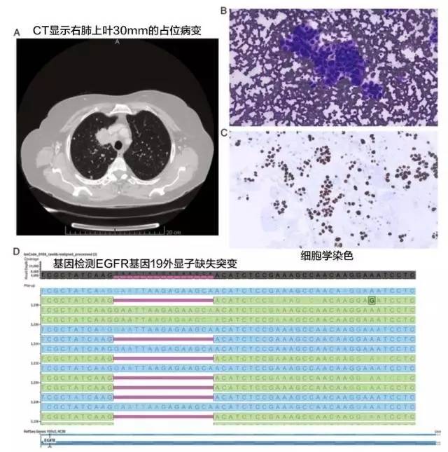 戒烟激活癌细胞_戒烟后真的会得癌吗_为什么突然戒烟会得癌