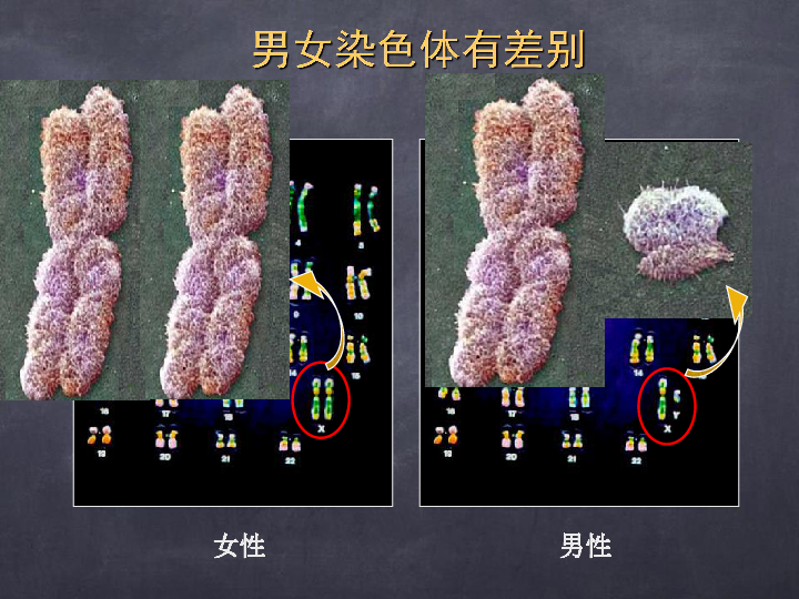 基底细胞癌_戒烟激活癌细胞_印戒细胞癌能活多久