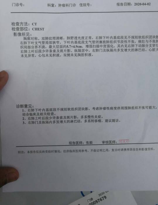 印戒细胞癌 英文_黑色素癌与基底细胞癌那个严重_戒烟激活癌细胞