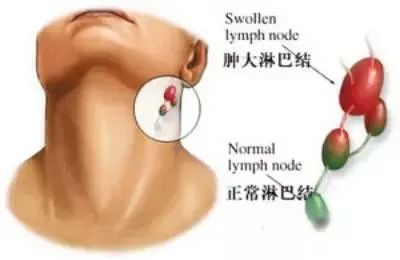 胃窦印戒细胞癌应该看哪个科_戒烟激活癌细胞_戒烟后得癌的人多不多